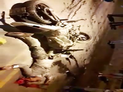 Head Destroyed after Accident 