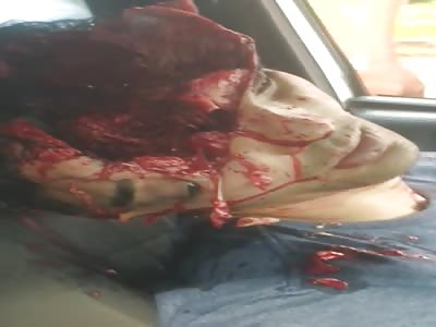 100% Gore ... Man Had His Head Blown Off  after Shot !!! 