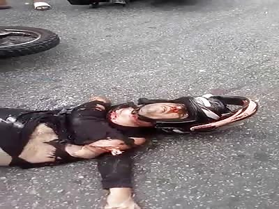 fucked man gets all contorted in a horrible accident..What Happened to this Man? 