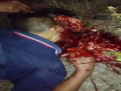 Head destroyed after get shot