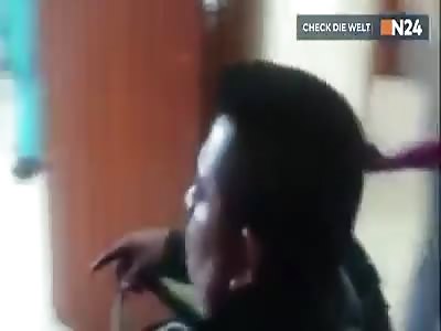 Knife in Head..... He's alive 