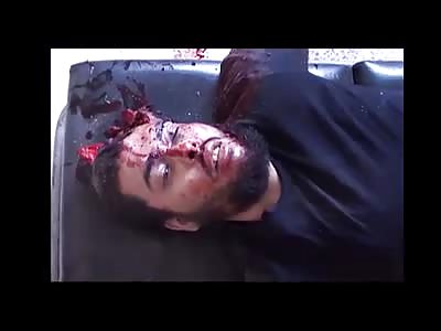 Man With Head Shot And Skull Cracked