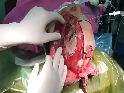 Apparently, it is a young victim of a car accident.