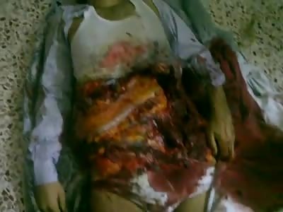 Brutally Killed By A Tank Shell 