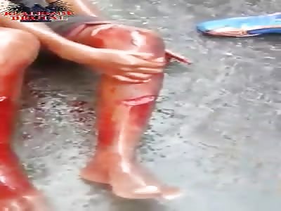 Young thief has his legs cut by machete PT2