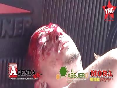 two youths hurt very bad from an accident