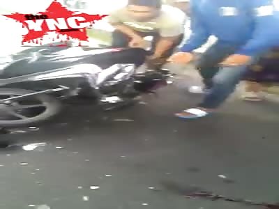 man relaxes after loosing some of his scalp 