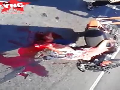 Youth looses a leg in the Philippines