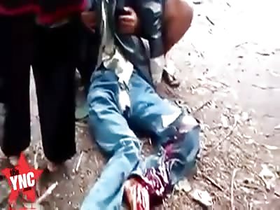 dying youth  with a bad leg