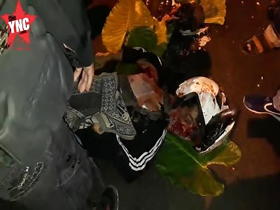 young student head gets crushed