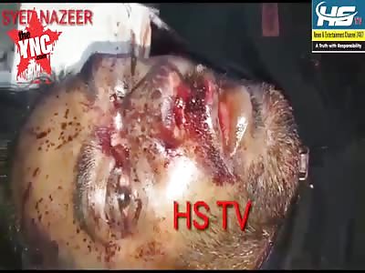 man choking on his own blood after a terrible accident  in Hyderabad, India 