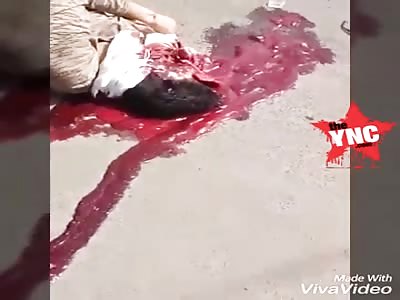 mans head crushed in Damoh