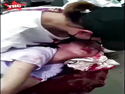 Unfortunately, the beautiful lady suffered a car accident