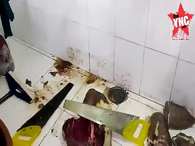 Dr Mantri   from Hoshangabad chopped up his servant due to an illicit relationship  