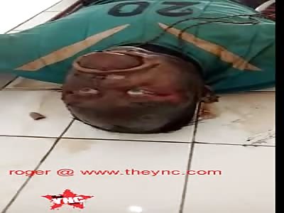 A bloated dead body at the morgue in North Sumatra