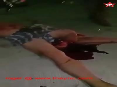 man in a lot of pain in the Philippines