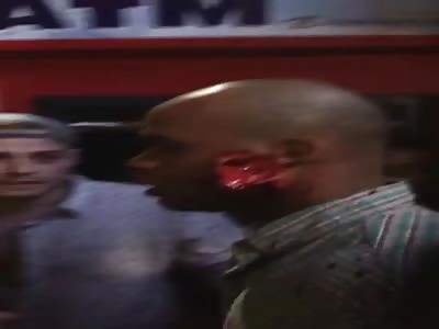 Homeboy gets a giant chunk taken out of his cheek