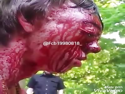 His face is about to explode!