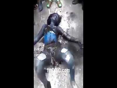 Woman in total agony after being burned by her ex-husband