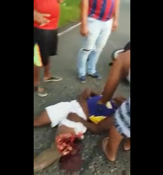 Man Torn Leg in Motorbike Accident 