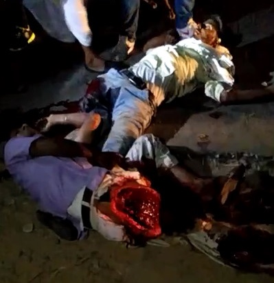 Broken Legs in Accident 