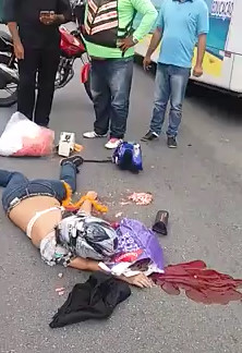 Helmet Didn't Work too Well