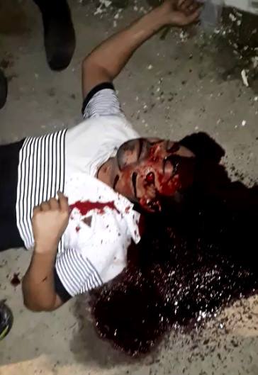 Bloody Crime Scene Happened this Week in Brazil X