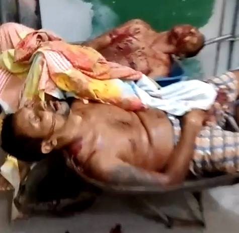 Bloody Crimes Scenes Happened this Week in Brazil XX