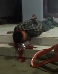 Handcuffed thief with Shot in the Head Still Agonizing on the Sidewalk