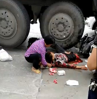 Woman still Alive after Crushed by a Truck