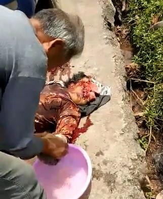 Elderly lady Head Crushed by a Truck