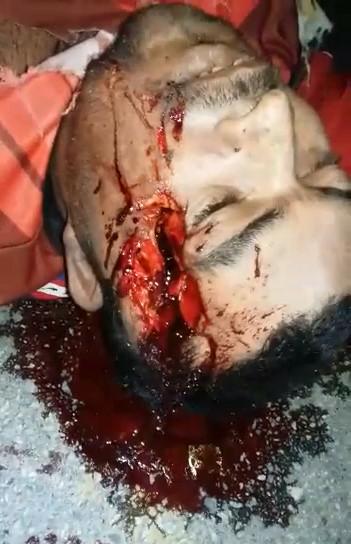 Brutal Impact Leaves Skulls Cracked 