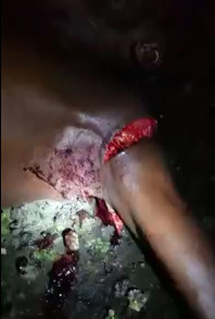 Man in Shock with his Arm Hacked after machete Attack