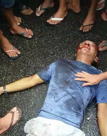 Bandit in Agony After Getting Shot to the Brain