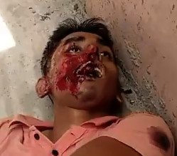 Bloody Crime Scene Happened Today in India