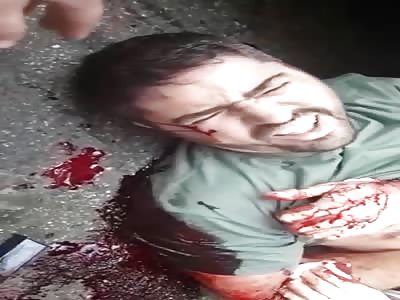 Policeman in Agony after get Shot in the Face 