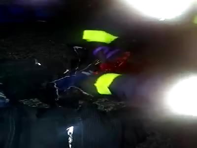 Biker Agonizing with Foot Destroyed by a Truck