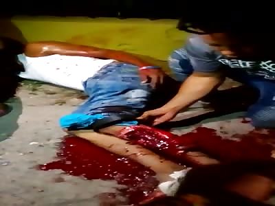 Horrific Leg Injury leaves Man in SHOCK