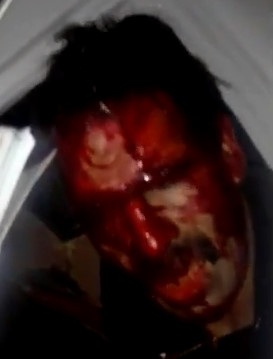 Car Crash Aftermath in Puebla , Mexico