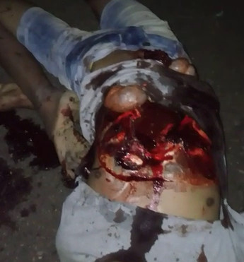 Gruesome Aftermath has his Intestines Leaking out his Side