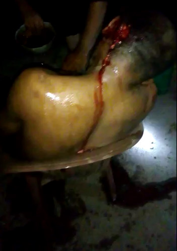 Bloody murder scene.