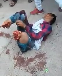 Another Failed Train Track Suicide