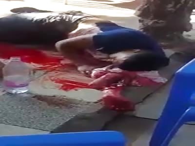 Machete Wound on Arm