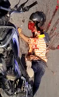 Helmet Didn't Work too Well ..... 