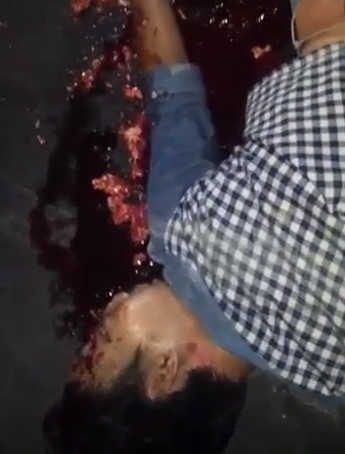 Mans Brains Splattered on the Road.