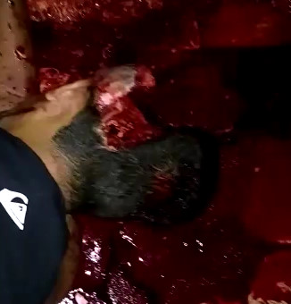 Dudes Brains Flew Out his Head