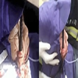 Iron Rod Through the FACE