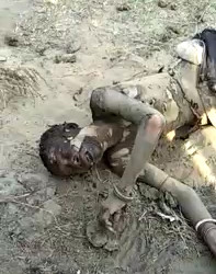 Man Burned Alive and Left for Dead