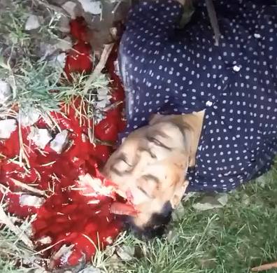 Man Spills Blood and Brain Matter after Train Accident 