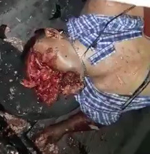 Man Ends His Car Ride with Destroyed Face